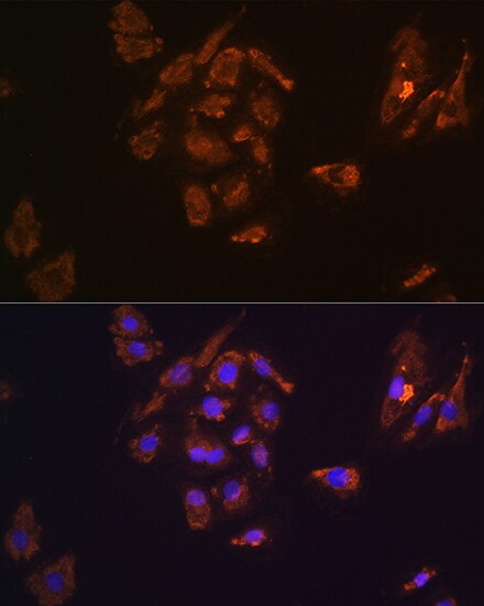Thyrotropin Releasing Hormone Antibody - Azide and BSA Free