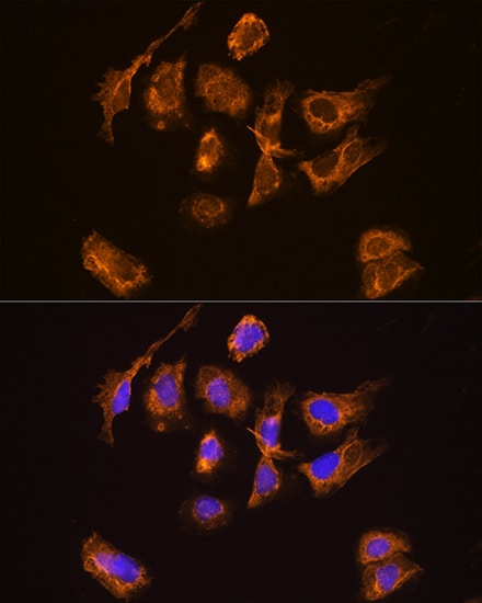 Thyrotropin Releasing Hormone Antibody - Azide and BSA Free