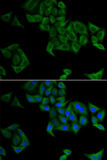 SMYD5 Antibody - BSA Free