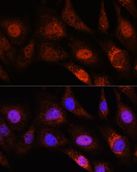 ZC3H12D Antibody - Azide and BSA Free