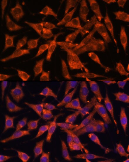 MT-ND1 Antibody - Azide and BSA Free