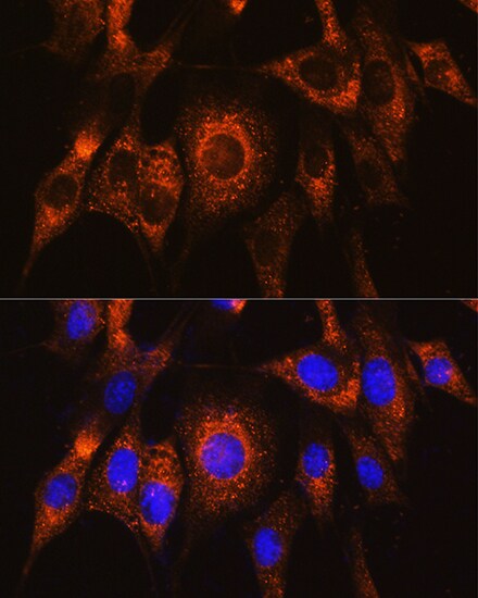 UBAC2 Antibody - Azide and BSA Free