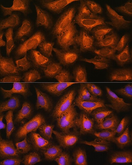 eIF2B4 Antibody - Azide and BSA Free