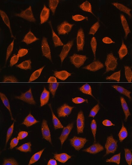 eIF2B4 Antibody - Azide and BSA Free