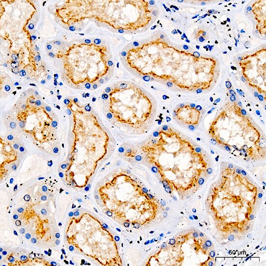 TRPV5 Antibody - BSA Free