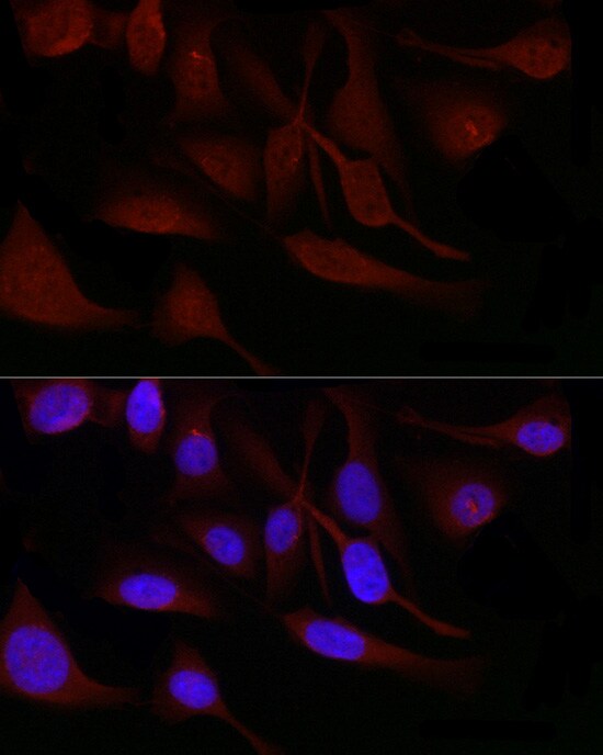 SNRPD1 Antibody - Azide and BSA Free