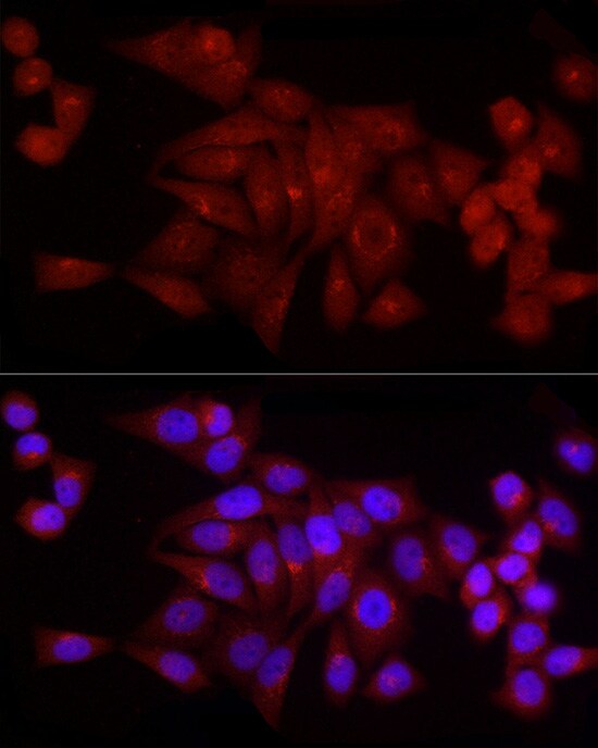 SNRPD1 Antibody - Azide and BSA Free