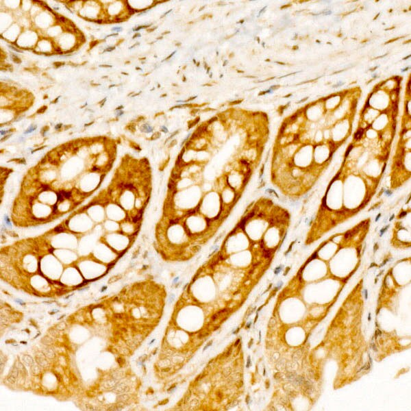 RPS10 Antibody - BSA Free