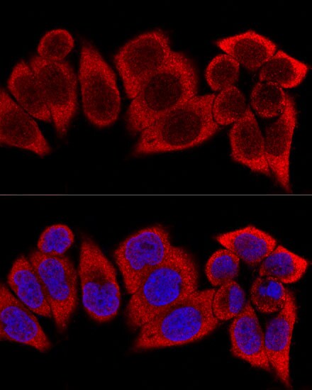 RPS12 Antibody - BSA Free