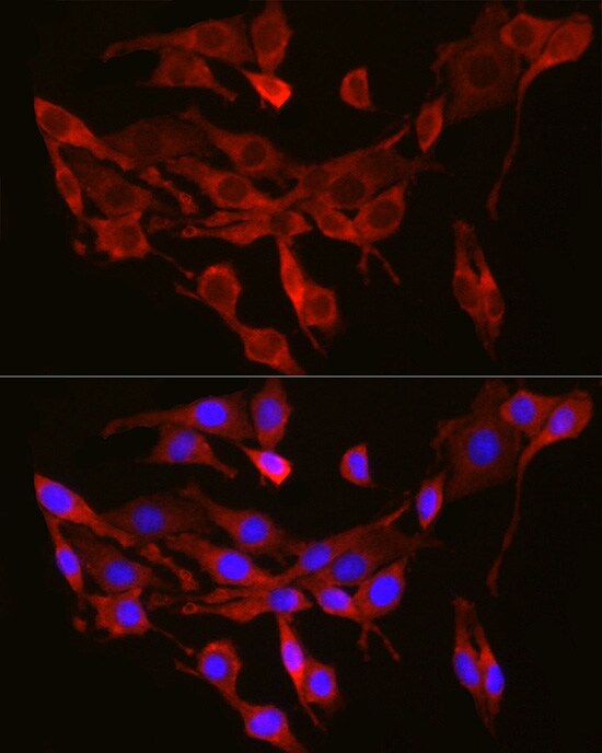 SEC61A Antibody - Azide and BSA Free