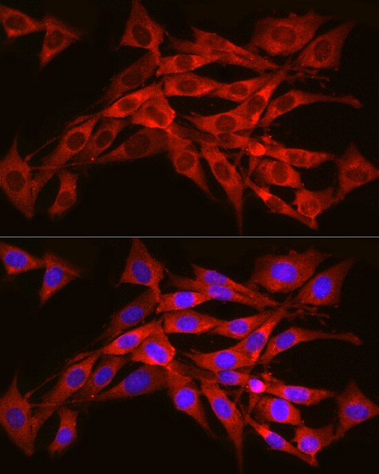 SEC61A Antibody - Azide and BSA Free