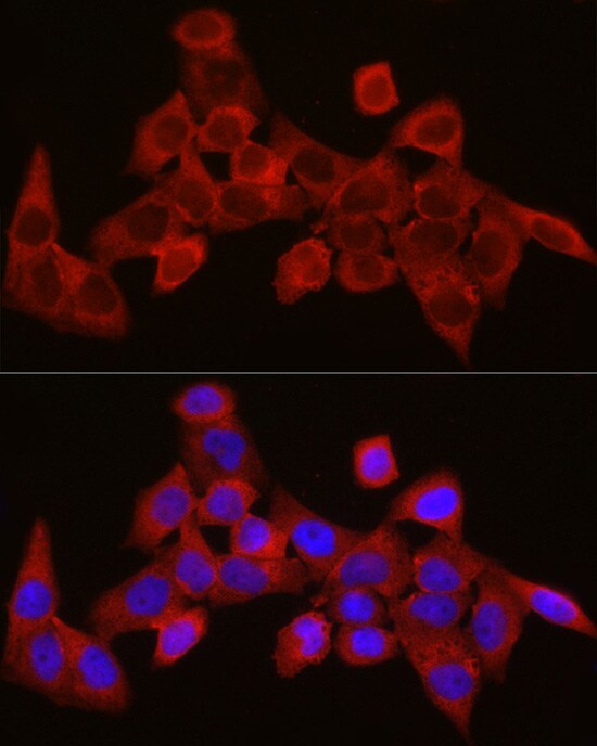 SEC61A Antibody - Azide and BSA Free