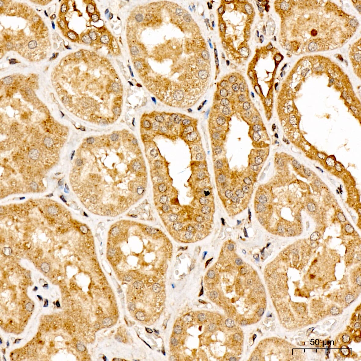 UPF2 Antibody - BSA Free