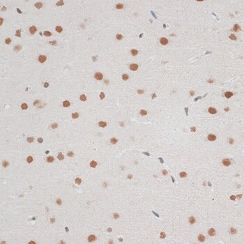 ZNF148 Antibody - BSA Free