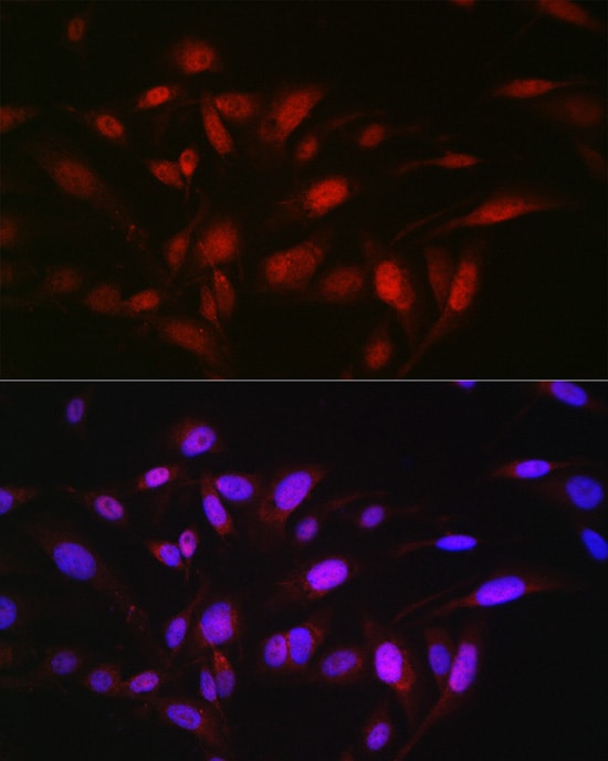 Zeta Opioid Receptor Antibody - Azide and BSA Free