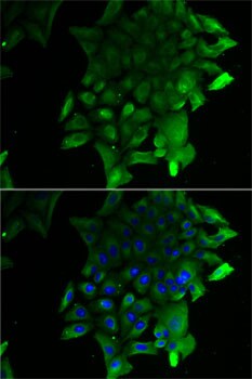 Soluble Liver/Pancreas Antigen Antibody - BSA Free