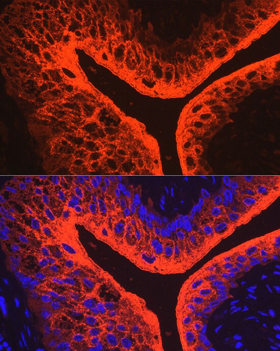 Uroplakin III Antibody - BSA Free