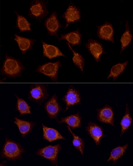 SUCLA2 Antibody - BSA Free