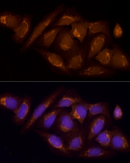 SUCLA2 Antibody - BSA Free