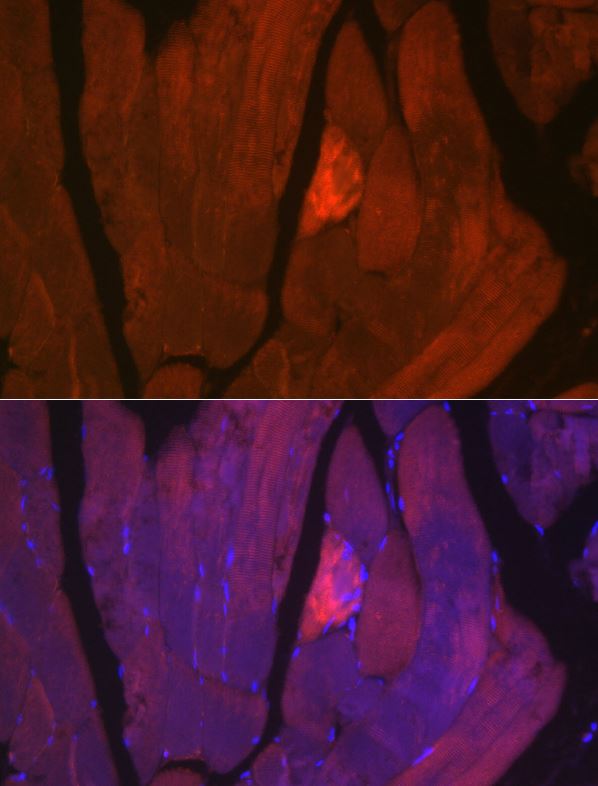Myosin heavy chain 2 Antibody