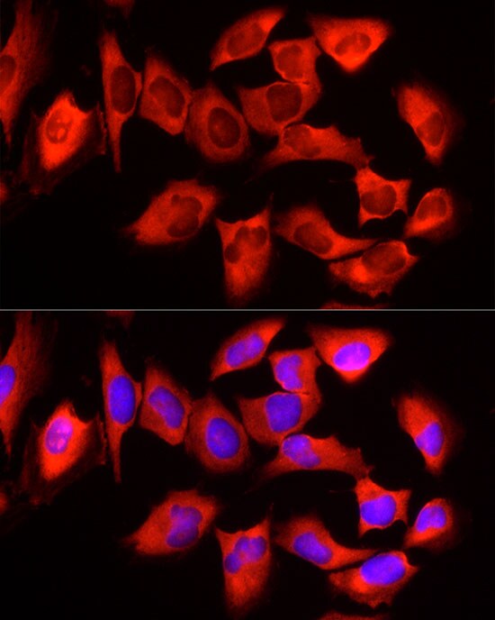 YTHDF3 Antibody - BSA Free