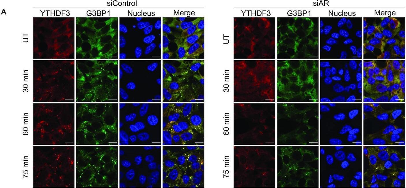 YTHDF3 Antibody - BSA Free