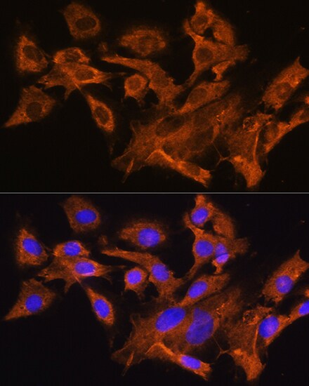 V1a Vasopressin R/AVPR1A Antibody - BSA Free