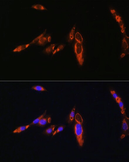 V1a Vasopressin R/AVPR1A Antibody - BSA Free