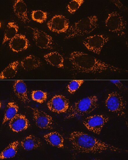 P4HA3 Antibody - Azide and BSA Free