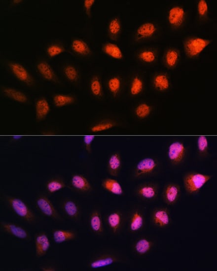 NPLOC4 Antibody - BSA Free