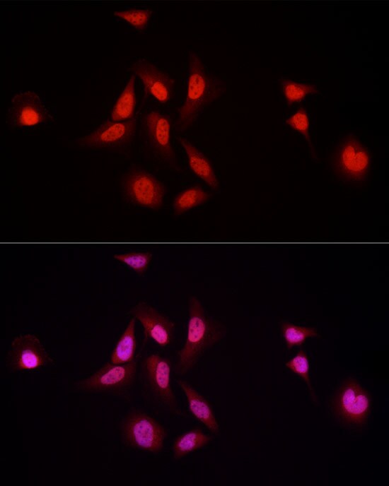 NFIA Antibody - BSA Free