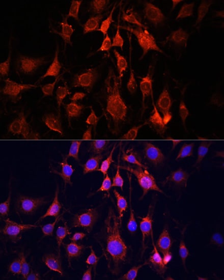 UCP3 Antibody - Azide and BSA Free