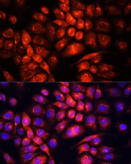 UCP3 Antibody - Azide and BSA Free