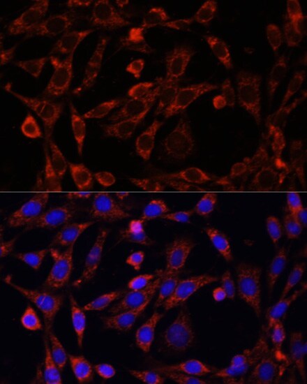 UCP3 Antibody - Azide and BSA Free