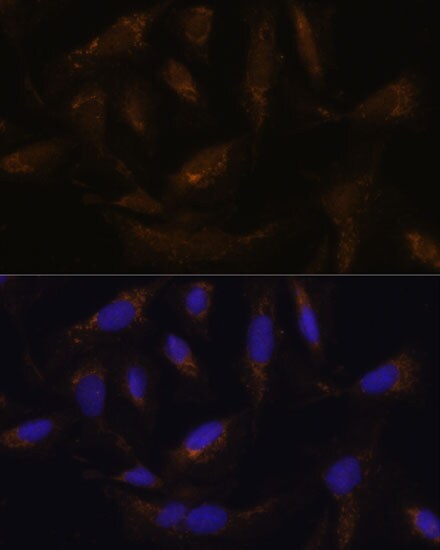 UCP4 Antibody - Azide and BSA Free