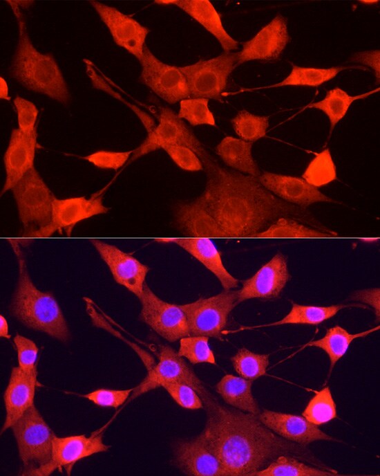 ULK1 Antibody - Azide and BSA Free