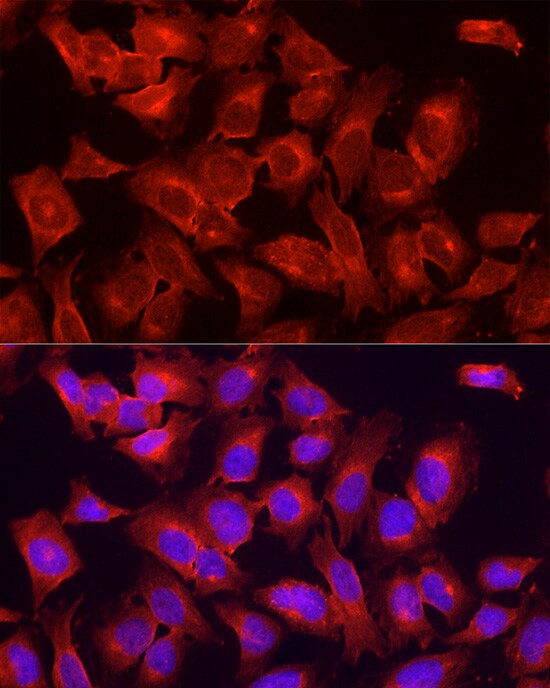 ULK1 Antibody - Azide and BSA Free