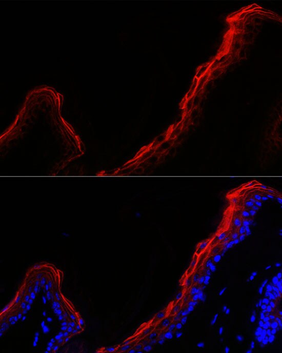 Periplakin Antibody - BSA Free
