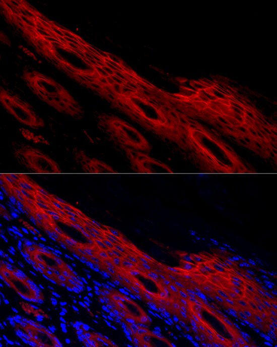 Periplakin Antibody - BSA Free