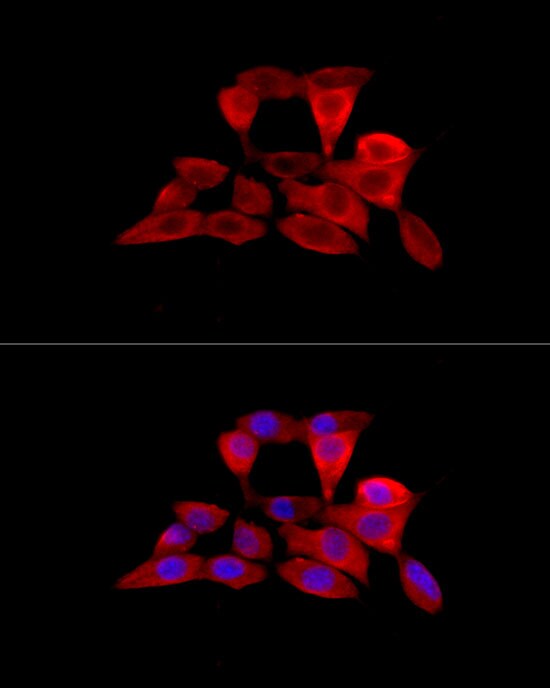 OCTN2/SLC22A5 Antibody - BSA Free