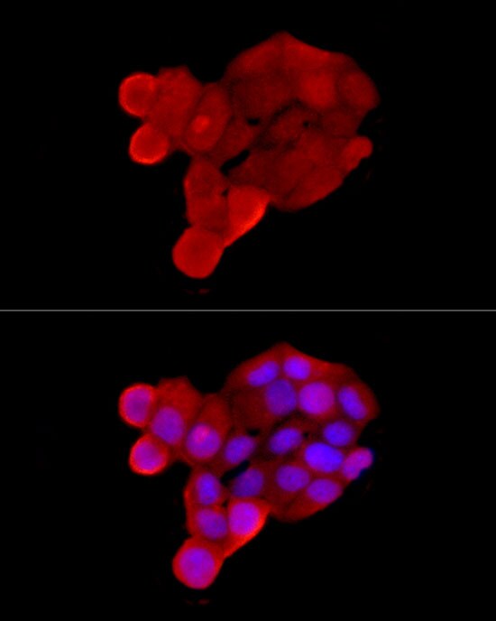 OCTN2/SLC22A5 Antibody - BSA Free