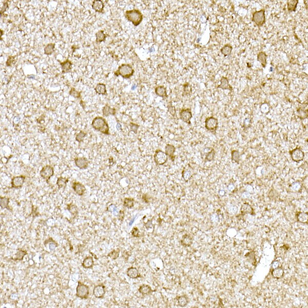TOMM20 Antibody - Azide and BSA Free