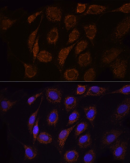TOMM20 Antibody - Azide and BSA Free