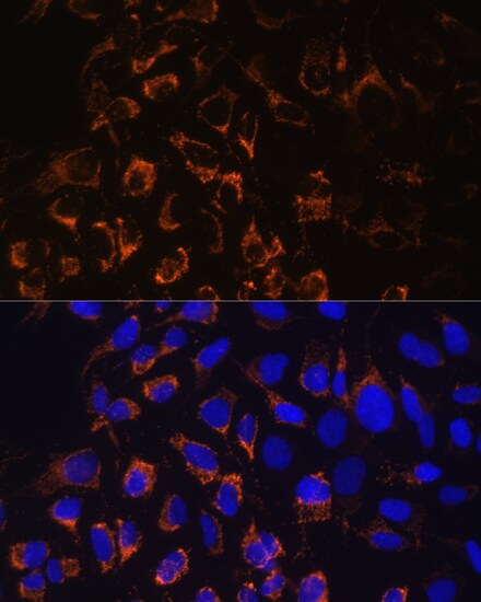 TOMM20 Antibody - Azide and BSA Free