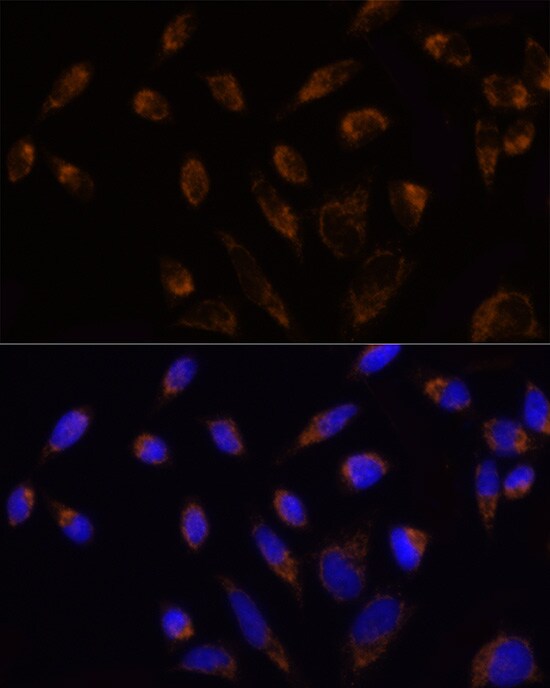 TOMM20 Antibody - Azide and BSA Free