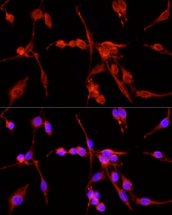 TSG101 Antibody - Azide and BSA Free