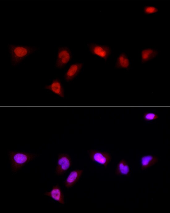 NSUN2 Antibody - BSA Free