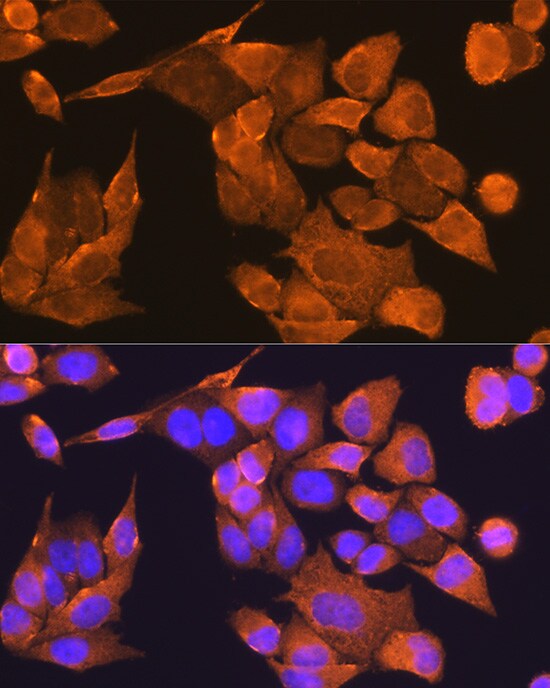 PFDN5 Antibody - Azide and BSA Free