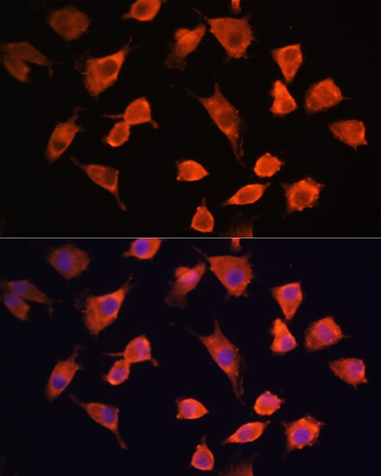 PFDN5 Antibody - Azide and BSA Free