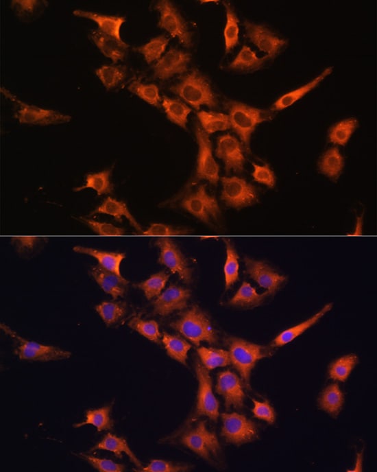 PFDN5 Antibody - Azide and BSA Free